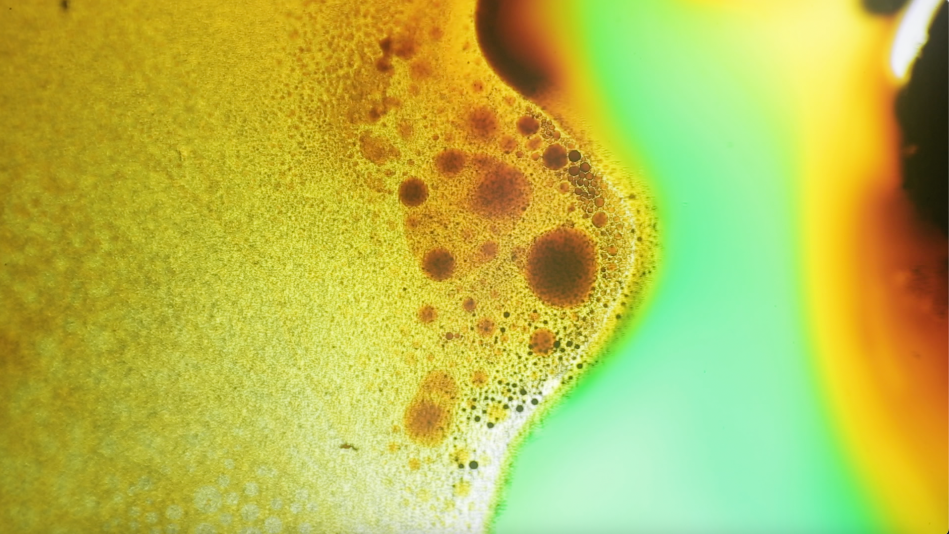 Gut Health and Endometriosis