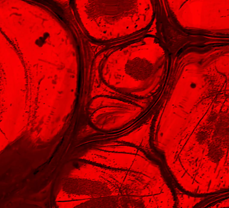 The Hidden Link Between PMDD and ADHD