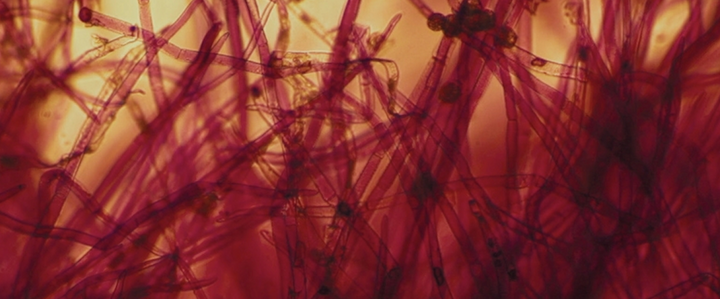 The Trauma Hormone-Connection: PMDD, PTSD & Estrogen