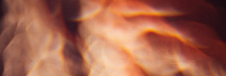 PMDD is costing women their careers
