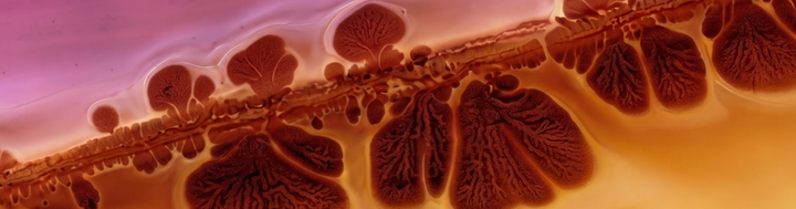 PMDD and the Overactive Glymphatic System
